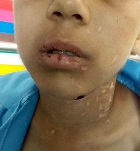 روایت تکان دهنده از حادثه کودک آزاری در سبزوار/ پدر و نامادری کودک آزار هنوز دستگیر نشده اند/ درخواست اشد مجازات برای پدر کودک آزار