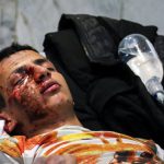 افزایش ٢٠٠ درصدی مصدومان چهارشنبه آخر سال