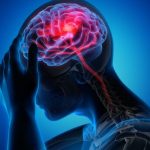 خبر خوب درباره عوارض سکته مغزی