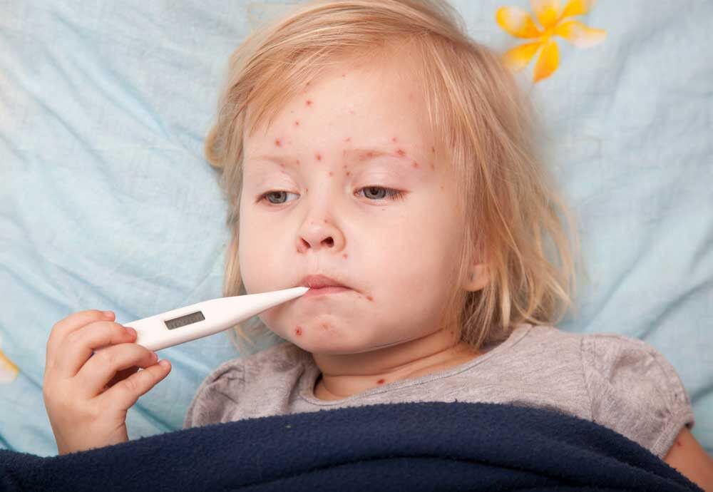 ۲۰۰ مورد ابتلا به سرخک در کشور شناسایی شد/ انجام واکسیناسیون به موقع کودکان