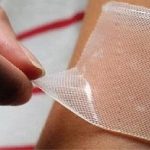 زخم‌های مزمن؛ یک اپیدمی بی‌سر و صدا / معضل «زخم بستر» در بیماران بستری