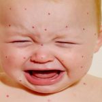بازگشت سرخک به اروپا