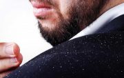 به جنگ با شوره سر با روش های ساده بروید!
