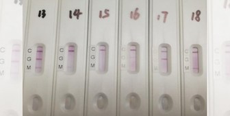 متخصصان ناجا در یک قدمی ساخت کیت های تشخیص کرونا متخصصان ناجا در یک قدمی ساخت کیت های تشخیص کرونا